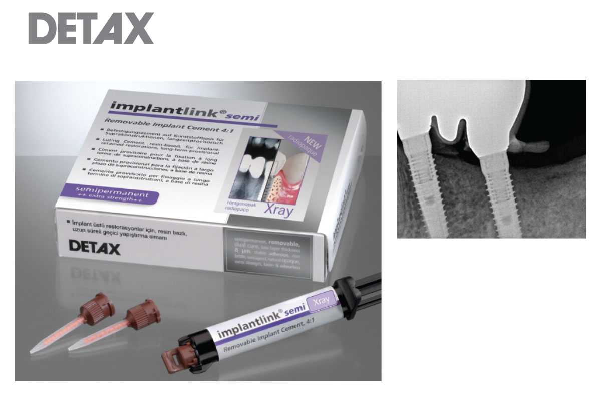 Implantlink® Semi X-Ray